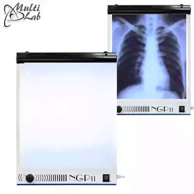 negatoscop_radiografie